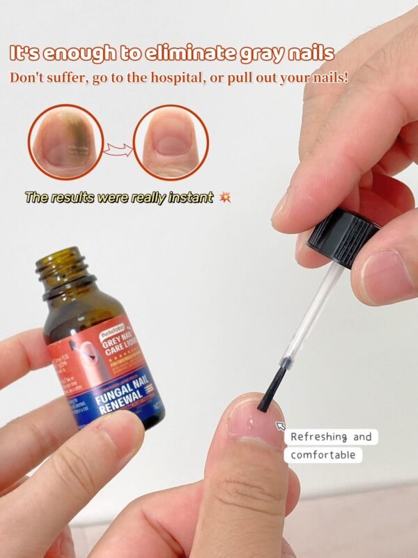 Meikefanbao-Grey Nail Care Liquid