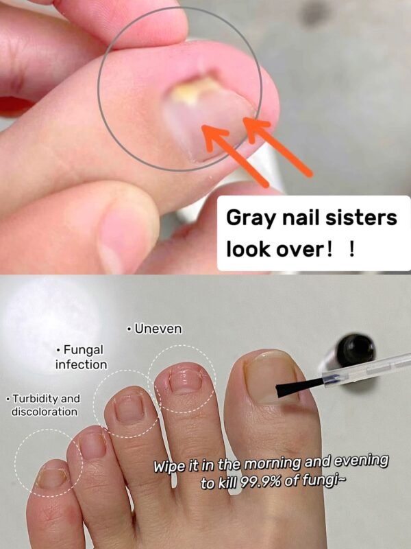 Meikefanbao-Grey Nail Care Liquid