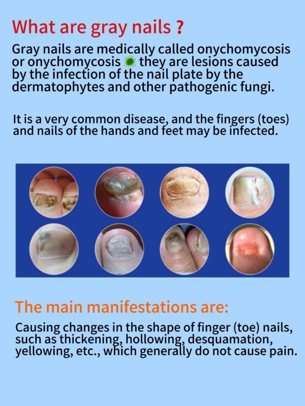 Meikefanbao-Grey Nail Care Liquid