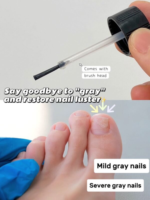 Meikefanbao-Grey Nail Care Liquid