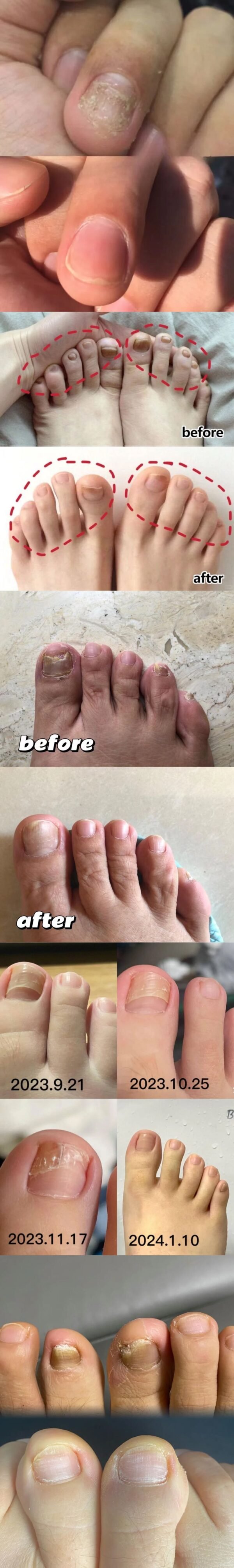 Meikefanbao-Grey Nail Care Liquid