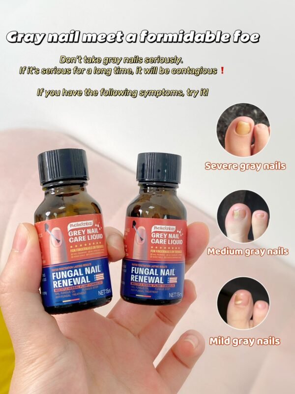 Meikefanbao-Grey Nail Care Liquid