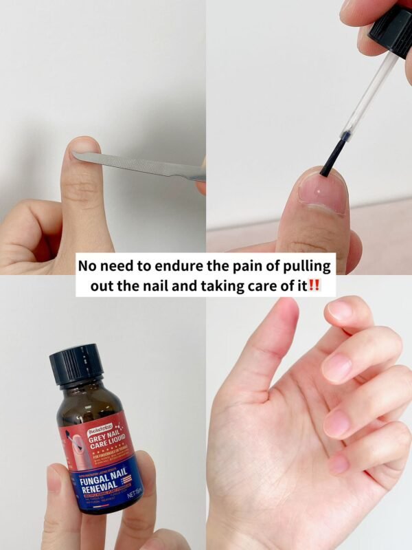 Meikefanbao-Grey Nail Care Liquid